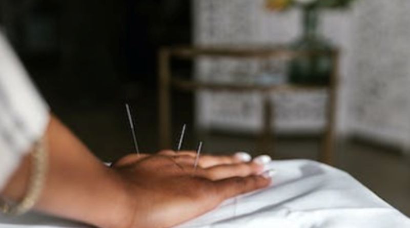 Acupuncture treatment